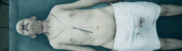 图片[13]-验尸模拟器 Autopsy Simulator v153.413 -飞星（官中）-蒸汽游戏宝库 - 高质量Steam单机游戏下载站